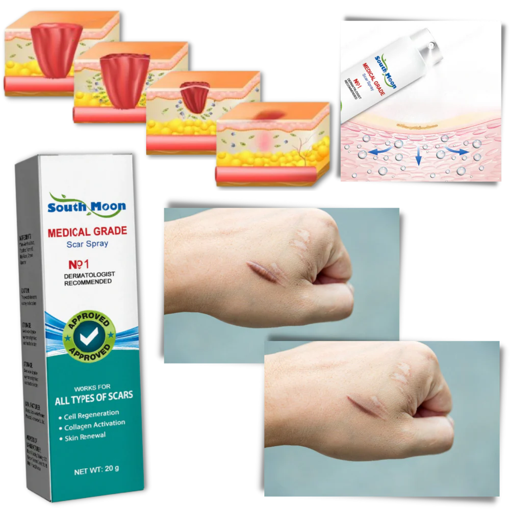Spray para cicatrices South Moon™ Medical Grade